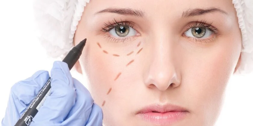 Blefaroplastia, operatia de corectare a pleoapei