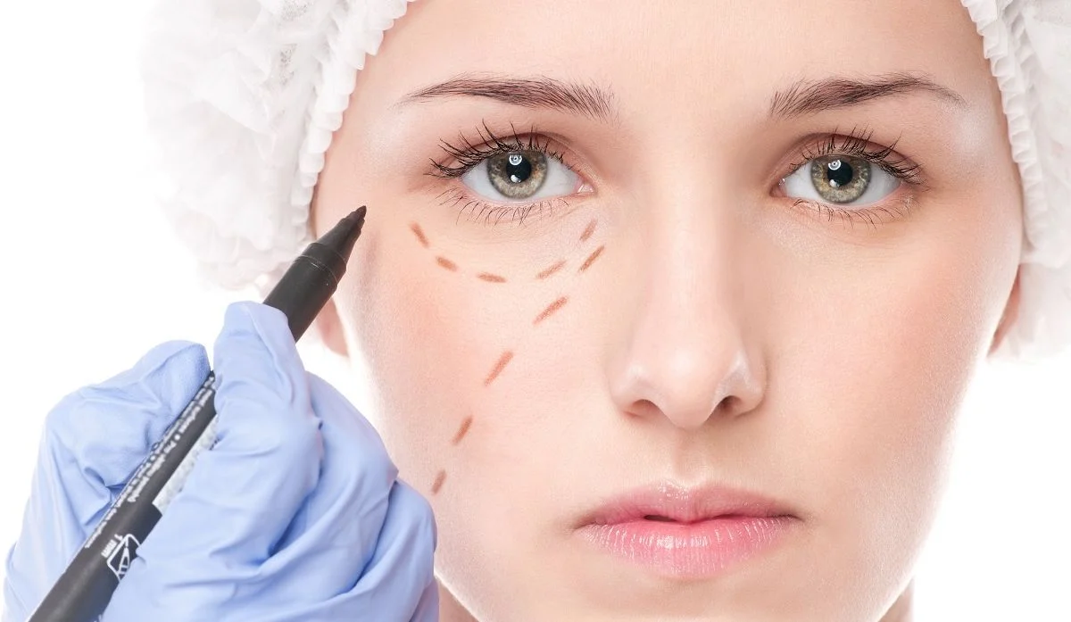 Blefaroplastia, operatia de corectare a pleoapei